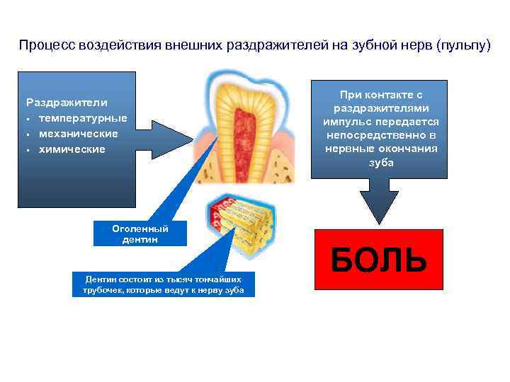 Процесс воздействия внешних раздражителей на зубной нерв (пульпу) Раздражители • температурные • механические •