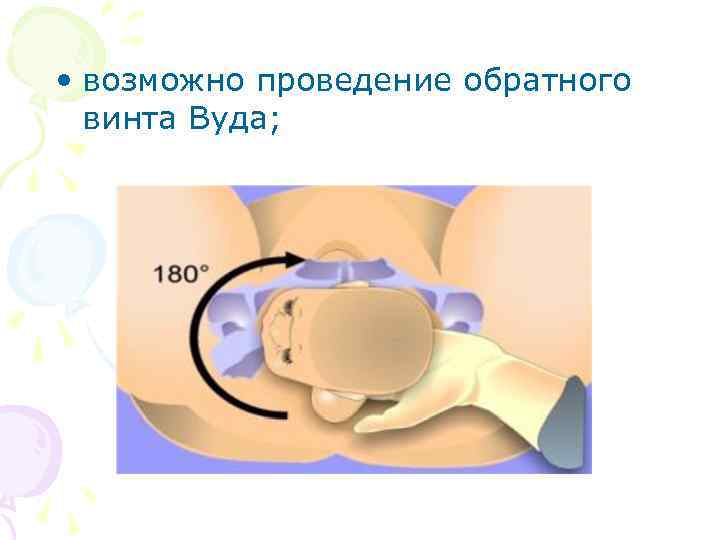  • возможно проведение обратного винта Вуда; 