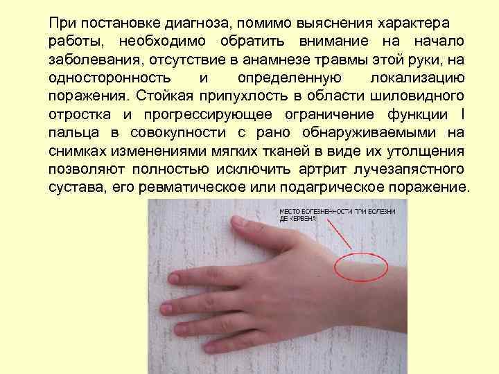 При постановке диагноза, помимо выяснения характера работы, необходимо обратить внимание на начало заболевания, отсутствие