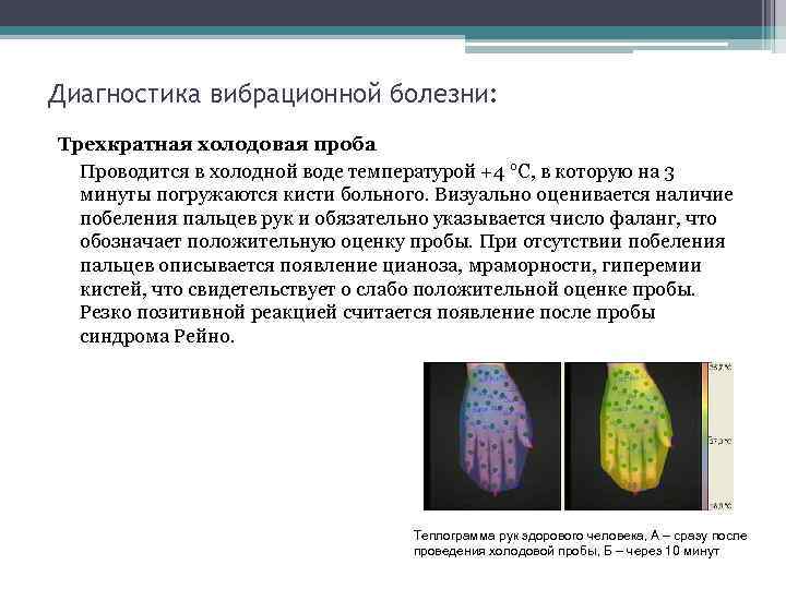 Диагностика вибрационной болезни: Трехкратная холодовая проба Проводится в холодной воде температурой +4 °С, в