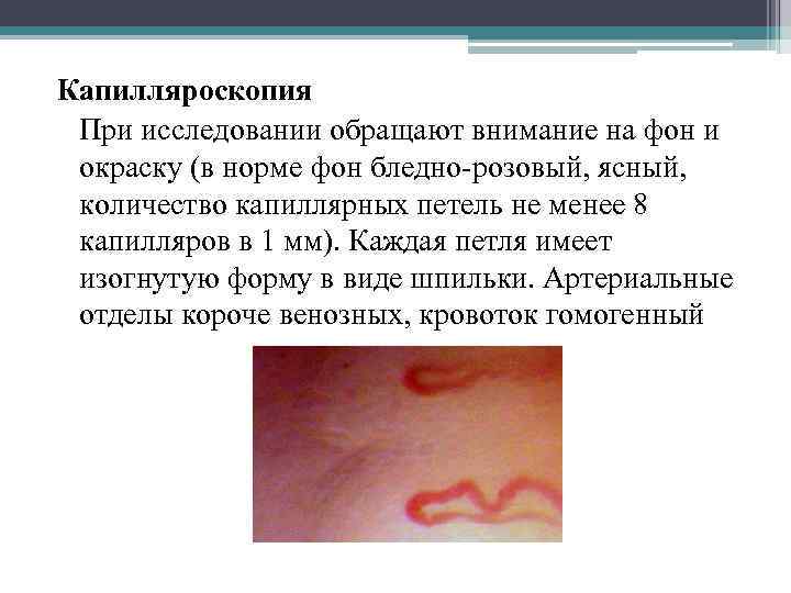 Капилляроскопия При исследовании обращают внимание на фон и окраску (в норме фон бледно-розовый, ясный,
