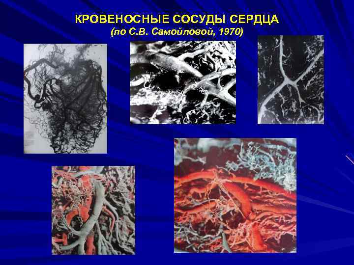 КРОВЕНОСНЫЕ СОСУДЫ СЕРДЦА (по С. В. Самойловой, 1970) 