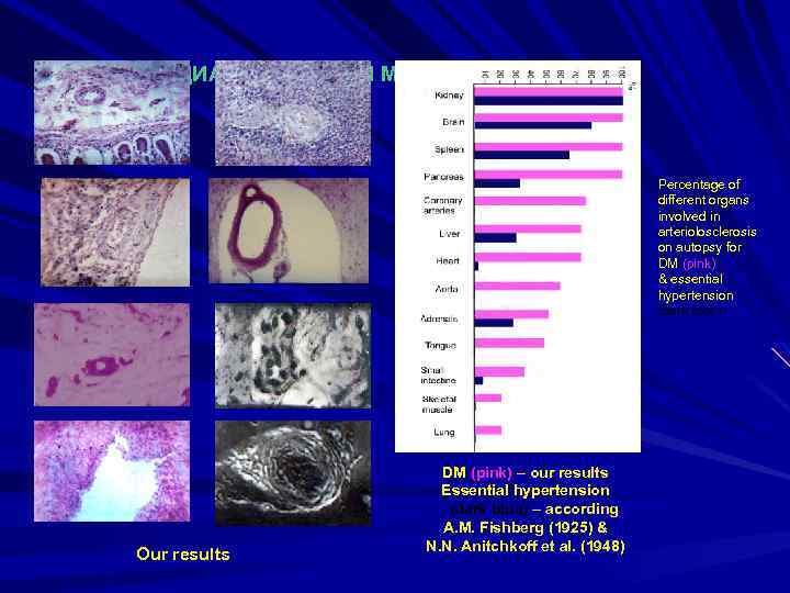 ДИАБЕТИЧЕСКАЯ МИКРОАНГИОПАТИЯ Percentage of different organs involved in arteriolosclerosis on autopsy for DM (pink)