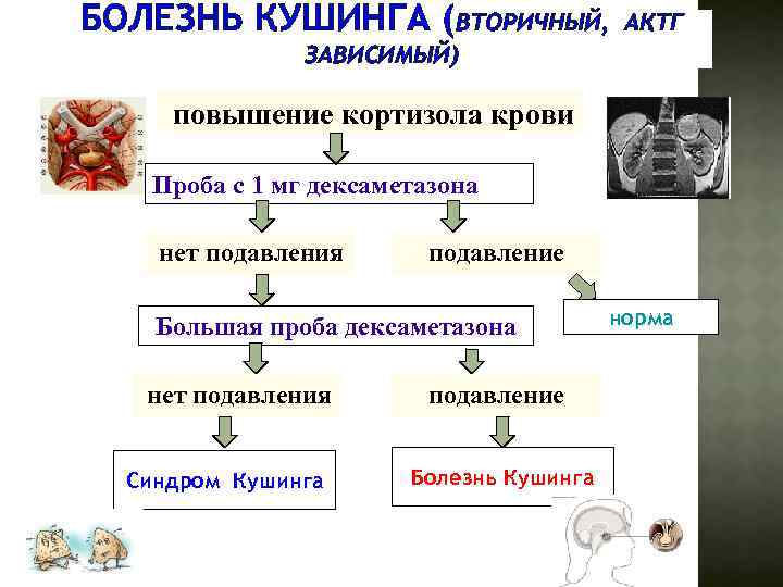 БОЛЕЗНЬ КУШИНГА (ВТОРИЧНЫЙ, АКТГ ЗАВИСИМЫЙ) повышение кортизола крови Проба с 1 мг дексаметазона нет