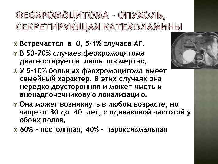 Встречается в 0, 5 -1% случаев АГ. В 50 -70% случаев феохромоцитома диагностируется лишь