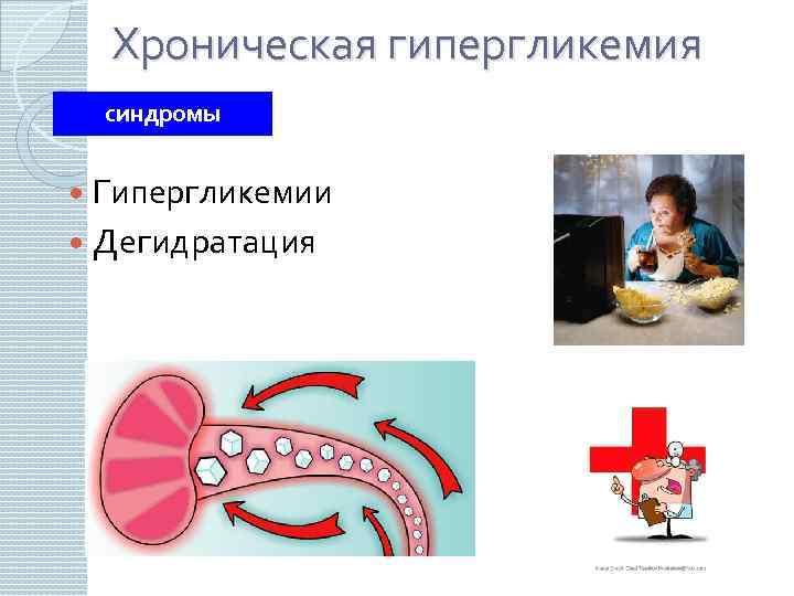 Хроническая гипергликемия синдромы Гипергликемии Дегидратация 