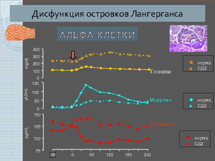 Дисфункция островков Лангерганса mg/d. L 400 300 200 Глюкоза 100 норма СД 2 μU/m.