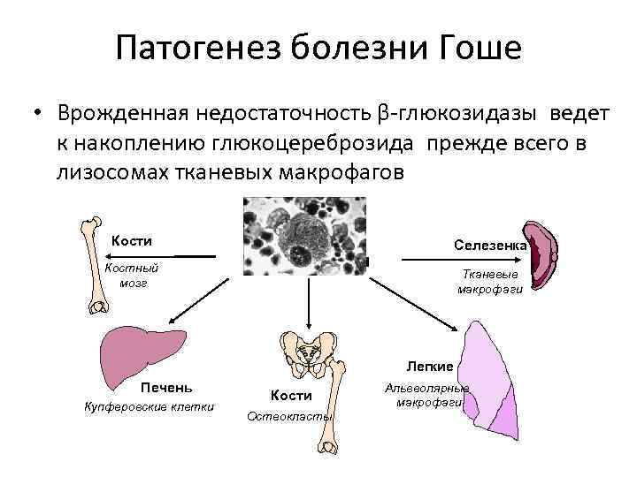 Причины и механизмы развития болезни