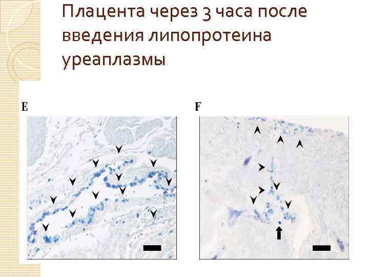 Плацента через 3 часа после введения липопротеина уреаплазмы 