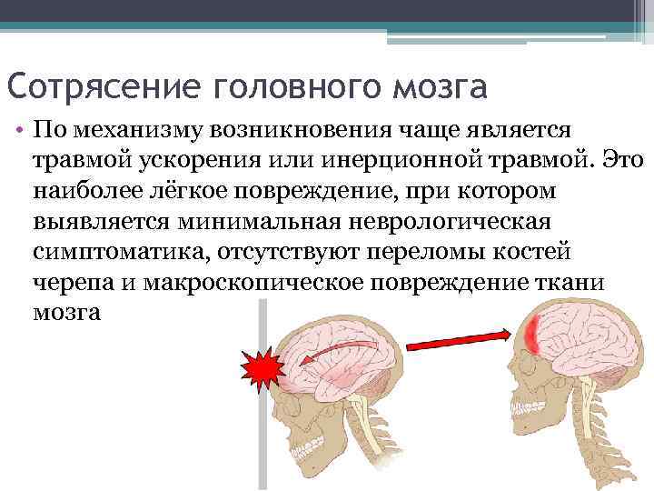 Сотрясение головного мозга • По механизму возникновения чаще является травмой ускорения или инерционной травмой.