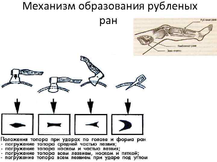 Описание раны