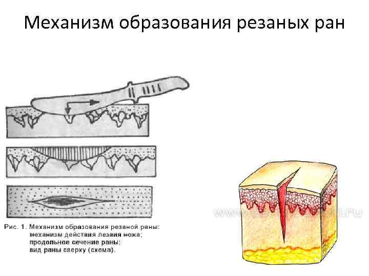 Ран в предмет