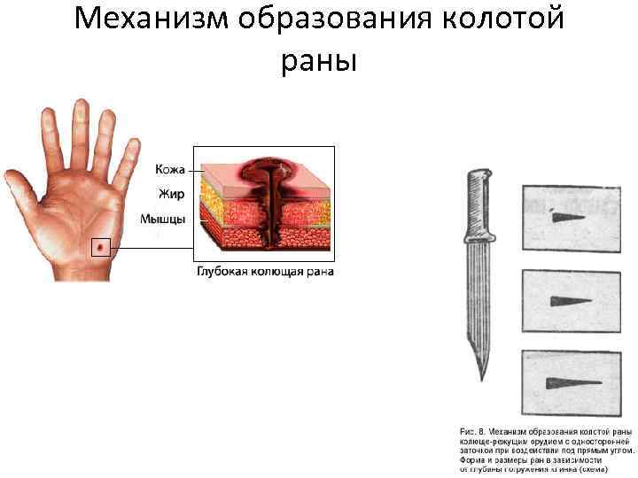 Механизм образования колотой раны 