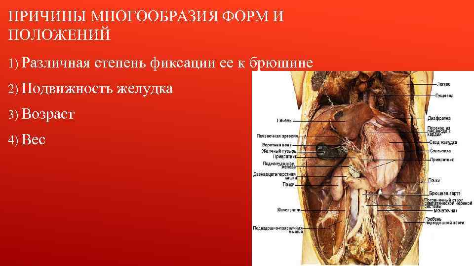 ПРИЧИНЫ МНОГООБРАЗИЯ ФОРМ И ПОЛОЖЕНИЙ 1) Различная степень фиксации ее к брюшине 2) Подвижность