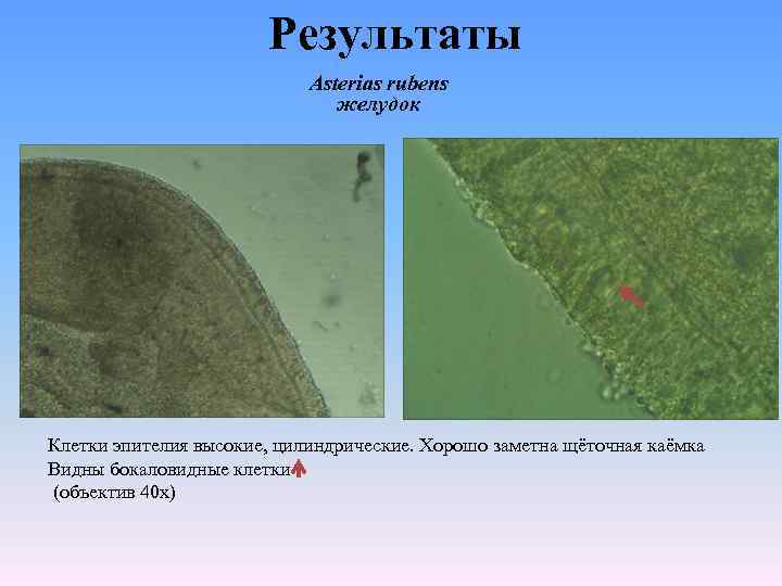 Результаты Asterias rubens желудок Клетки эпителия высокие, цилиндрические. Хорошо заметна щёточная каёмка Видны бокаловидные