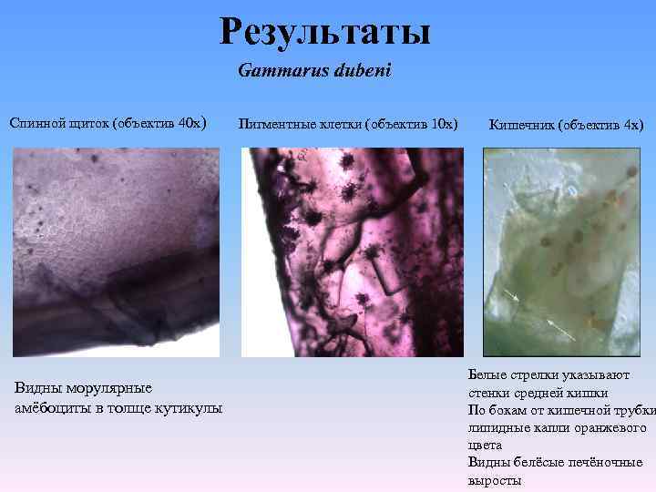 Результаты Gammarus dubeni Спинной щиток (объектив 40 х) Видны морулярные амёбоциты в толще кутикулы