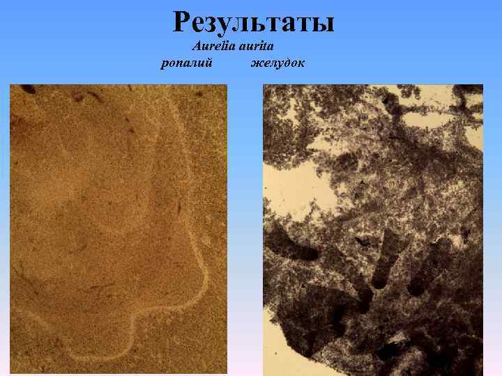 Результаты Aurelia aurita ропалий желудок 