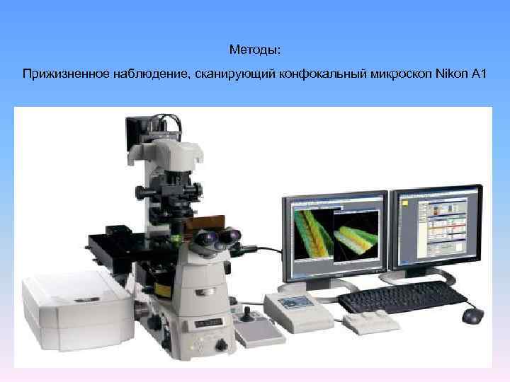 Методы: Прижизненное наблюдение, сканирующий конфокальный микроскоп Nikon A 1 