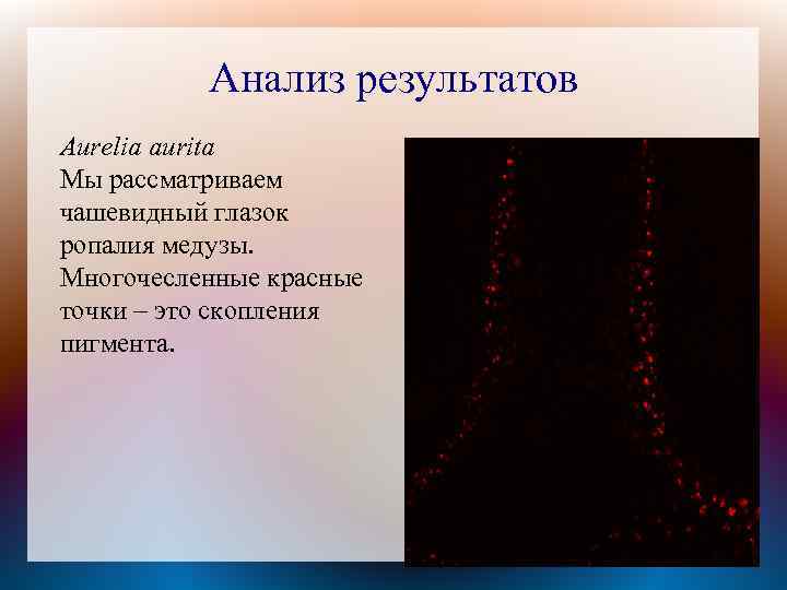 Анализ результатов Aurelia aurita Мы рассматриваем чашевидный глазок ропалия медузы. Многочесленные красные точки –