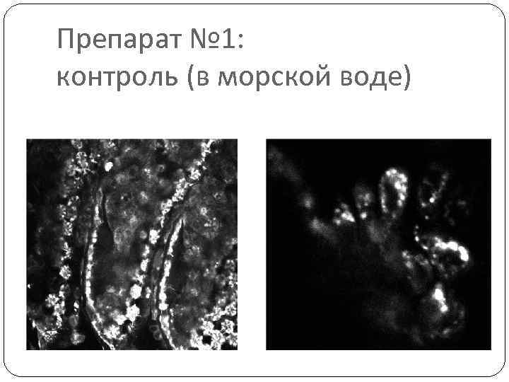 Препарат № 1: контроль (в морской воде) 