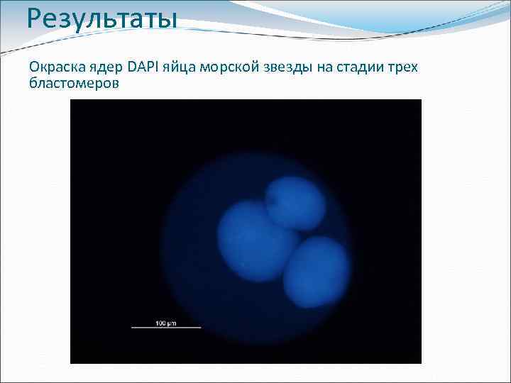 Результаты Окраска ядер DAPI яйца морской звезды на стадии трех бластомеров 