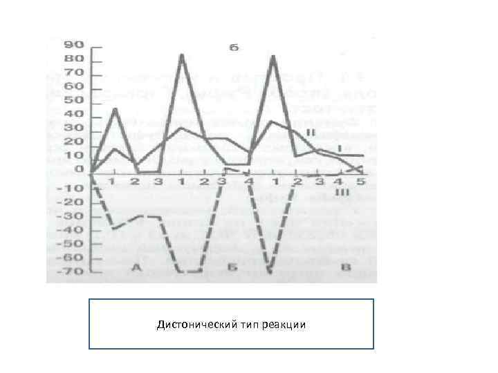 Дистонический тип реакции 