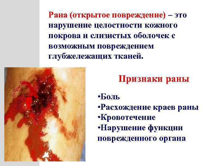 Рана (открытое повреждение) – это нарушение целостности кожного покрова и слизистых оболочек с возможным