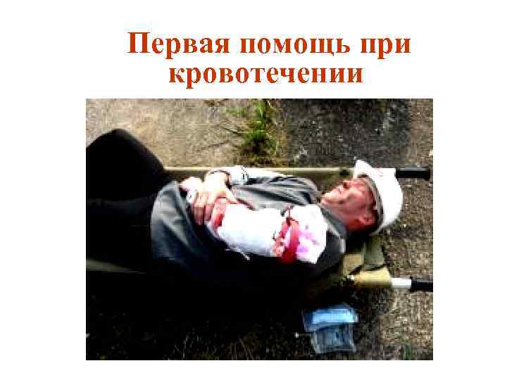 Первая помощь при кровотечении 