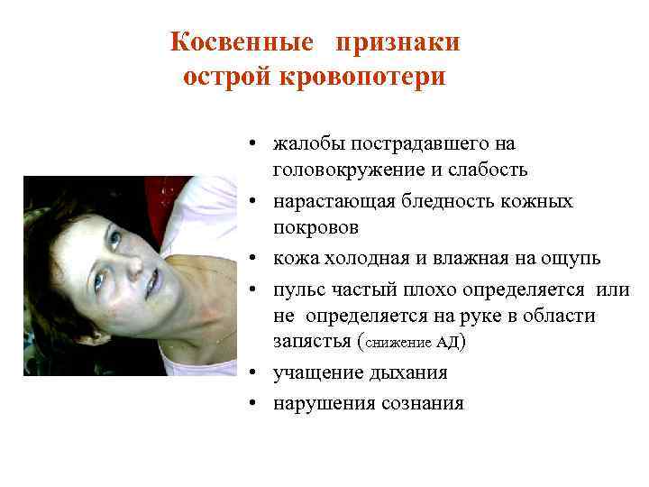 Косвенные признаки острой кровопотери • жалобы пострадавшего на головокружение и слабость • нарастающая бледность