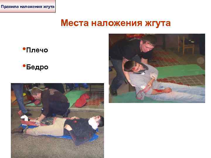 Правила наложения жгута Места наложения жгута • Плечо • Бедро 