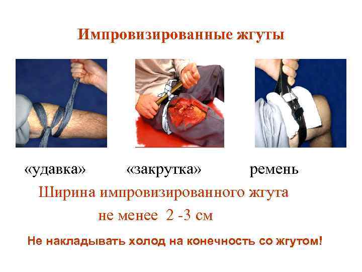 Импровизированные жгуты «удавка» «закрутка» ремень Ширина импровизированного жгута не менее 2 -3 см Не