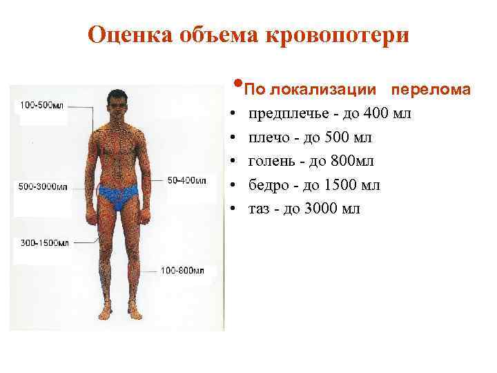Оценка объема кровопотери • По локализации • • • перелома предплечье - до 400