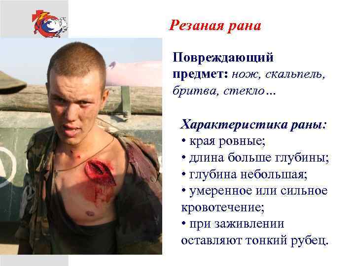 Резаная рана Повреждающий предмет: нож, скальпель, бритва, стекло… Характеристика раны: • края ровные; •