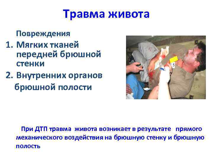 Травма живота Повреждения 1. Мягких тканей передней брюшной стенки 2. Внутренних органов брюшной полости
