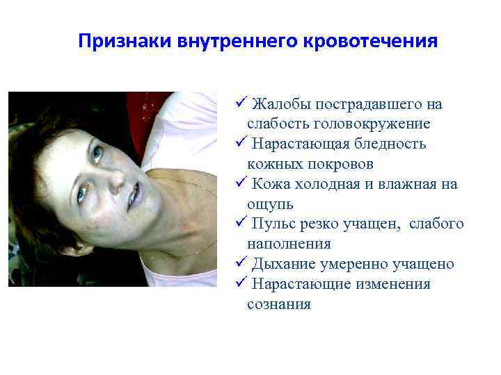 Признаки внутреннего кровотечения ü Жалобы пострадавшего на слабость головокружение ü Нарастающая бледность кожных покровов