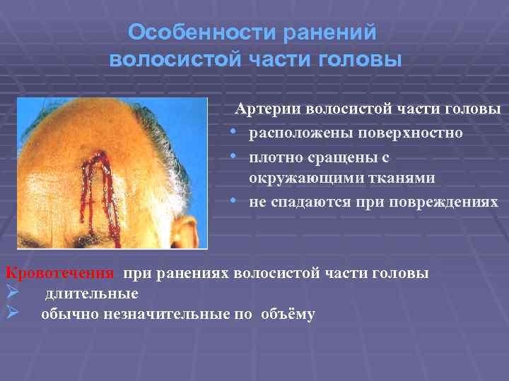 Особенности ранений волосистой части головы Артерии волосистой части головы • расположены поверхностно • плотно