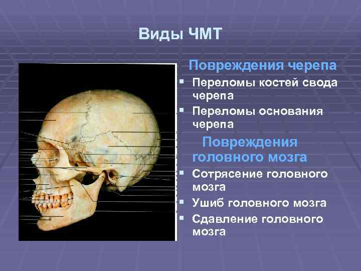 Карта вызова смп перелом основания черепа