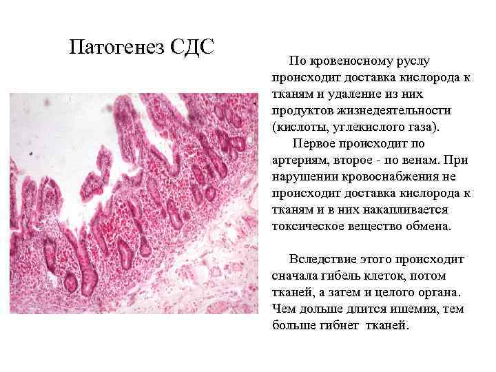 Патогенез СДС По кровеносному руслу происходит доставка кислорода к тканям и удаление из них