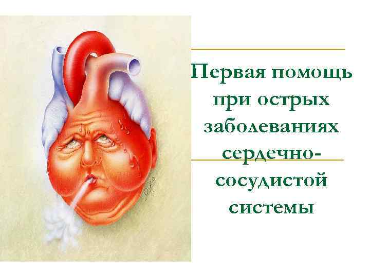 Первая помощь при острых заболеваниях сердечнососудистой системы 