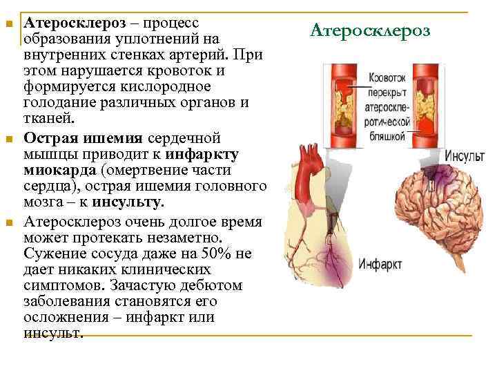 n n n Атеросклероз – процесс образования уплотнений на внутренних стенках артерий. При этом