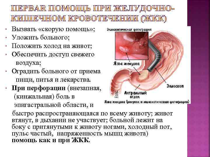  • • • Вызвать «скорую помощь» ; Уложить больного; Положить холод на живот;