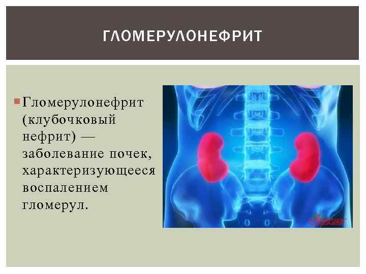 ГЛОМЕРУЛОНЕФРИТ Гломерулонефрит (клубочковый нефрит) — заболевание почек, характеризующееся воспалением гломерул. 