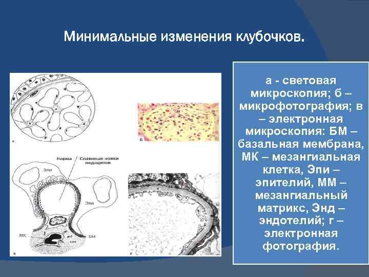 Базальная мембрана клубочка. Световая микроскопия. Мезангиальные клетки. Минимальные изменения клубочков. Мезангиального матрикса это.