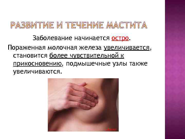 Заболевание начинается остро. Пораженная молочная железа увеличивается, становится более чувствительной к прикосновению, подмышечные узлы