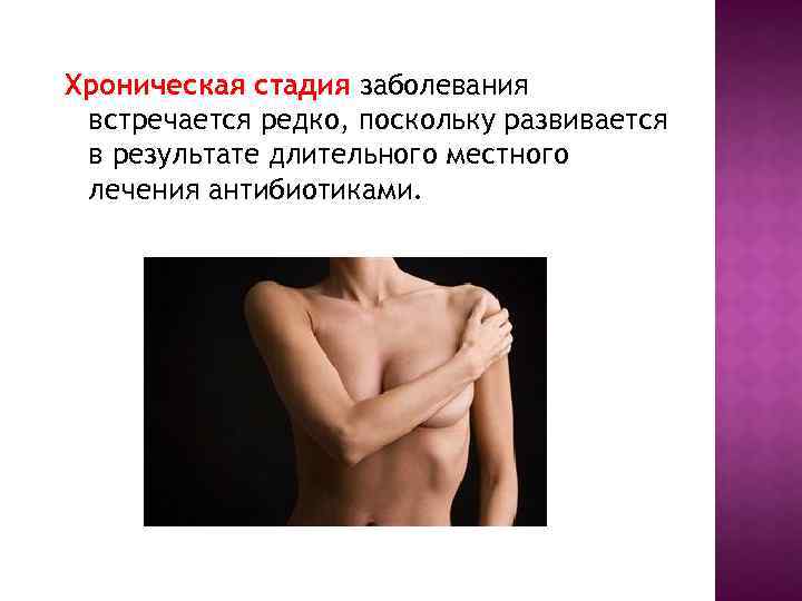 Хроническая стадия заболевания встречается редко, поскольку развивается в результате длительного местного лечения антибиотиками. 