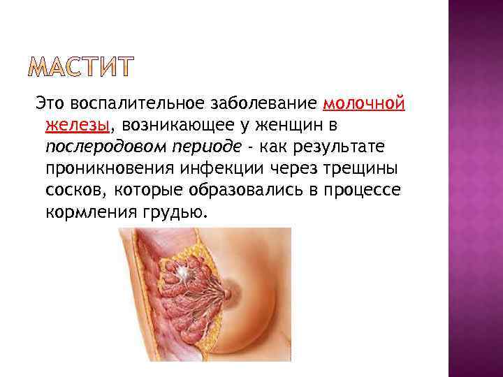  Это воспалительное заболевание молочной железы, возникающее у женщин в послеродовом периоде - как