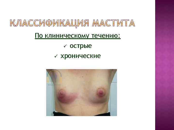 По клиническому течению: острые хронические 