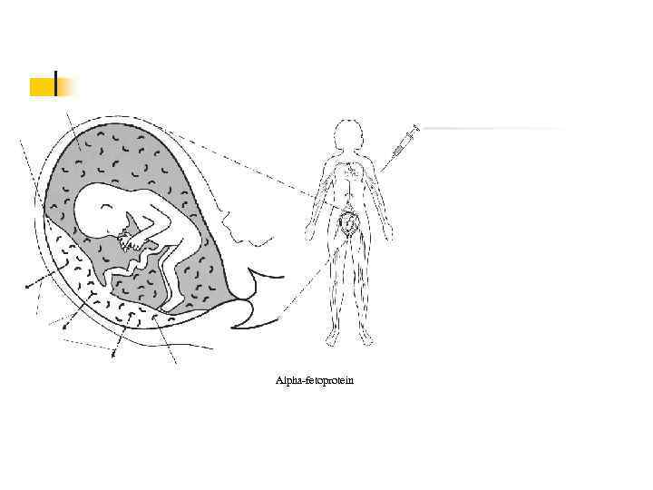 Placenta Maternal Bloodstream Alpha-fetoprotein 