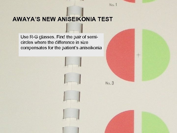 AWAYA’S NEW ANISEIKONIA TEST Use R-G glasses. Find the pair of semicircles where the