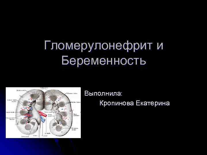 Гломерулонефрит и Беременность Выполнила: Кропинова Екатерина 